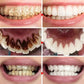 5D Teeth Whitening Stick – Fresh Breath Oral Care for Instantly Brighter Smile